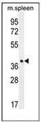 Tetraspan membrane protein of hair cell stereocilia antibody, AP52475PU-N, Origene, Western Blot image 