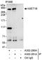 SET Domain Containing 1B, Histone Lysine Methyltransferase antibody, A302-281A, Bethyl Labs, Immunoprecipitation image 
