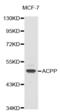 Acid Phosphatase, Prostate antibody, abx001583, Abbexa, Western Blot image 