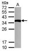 NME/NM23 Family Member 9 antibody, PA5-30945, Invitrogen Antibodies, Western Blot image 