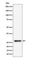 SBDS Ribosome Maturation Factor antibody, M02396, Boster Biological Technology, Western Blot image 