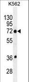 Transmembrane Protein 151B antibody, LS-C161986, Lifespan Biosciences, Western Blot image 