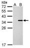 Collagen Type XI Alpha 2 Chain antibody, GTX128011, GeneTex, Western Blot image 