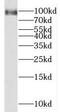 Alpha-1,6-Mannosylglycoprotein 6-Beta-N-Acetylglucosaminyltransferase B antibody, FNab05161, FineTest, Western Blot image 