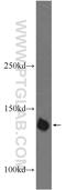 PHD Finger Protein 20 antibody, 22010-1-AP, Proteintech Group, Western Blot image 