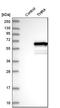 Thyroid Hormone Receptor Alpha antibody, HPA009654, Atlas Antibodies, Western Blot image 