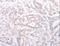 Ankyrin Repeat Family A Member 2 antibody, LS-C402622, Lifespan Biosciences, Immunohistochemistry paraffin image 