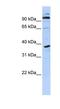 PHD Finger Protein 11 antibody, NBP1-80332, Novus Biologicals, Western Blot image 