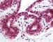 TNF Receptor Superfamily Member 10a antibody, 49-324, ProSci, Immunohistochemistry paraffin image 