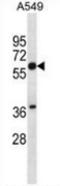 Squalene Epoxidase antibody, AP54036PU-N, Origene, Western Blot image 