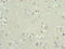 Kv channel-interacting protein 2 antibody, LS-C682124, Lifespan Biosciences, Immunohistochemistry paraffin image 