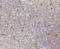 Cyclin Dependent Kinase 2 antibody, 13-811, ProSci, Immunohistochemistry paraffin image 
