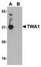 GID Complex Subunit 8 Homolog antibody, PA5-20799, Invitrogen Antibodies, Western Blot image 