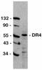 TNF Receptor Superfamily Member 10a antibody, ab8414, Abcam, Western Blot image 