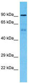 Zinc finger protein 658B antibody, TA342129, Origene, Western Blot image 