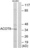 Acyl-CoA Thioesterase 8 antibody, LS-B13425, Lifespan Biosciences, Western Blot image 