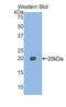 Myosin Light Chain 2 antibody, LS-C295511, Lifespan Biosciences, Western Blot image 