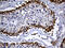 Dehydrogenase/Reductase 4 Like 2 antibody, M16262, Boster Biological Technology, Immunohistochemistry paraffin image 