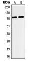 HIF3-alpha antibody, MBS821905, MyBioSource, Western Blot image 