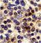 C-X3-C Motif Chemokine Receptor 1 antibody, PA5-19935, Invitrogen Antibodies, Immunohistochemistry paraffin image 
