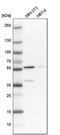 3-Oxoacid CoA-Transferase 1 antibody, PA5-52899, Invitrogen Antibodies, Western Blot image 