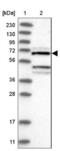 Dual Specificity Tyrosine Phosphorylation Regulated Kinase 4 antibody, NBP1-89511, Novus Biologicals, Western Blot image 