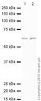 Furin, Paired Basic Amino Acid Cleaving Enzyme antibody, ab3467, Abcam, Western Blot image 