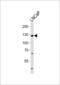 Transient Receptor Potential Cation Channel Subfamily M Member 8 antibody, 56-033, ProSci, Western Blot image 
