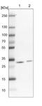 TPD52 Like 2 antibody, NBP2-13468, Novus Biologicals, Western Blot image 
