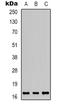 Angiogenin antibody, LS-C413308, Lifespan Biosciences, Western Blot image 