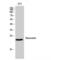 Recoverin antibody, LS-C385802, Lifespan Biosciences, Western Blot image 