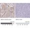 Smoothelin antibody, NBP2-37931, Novus Biologicals, Immunohistochemistry paraffin image 