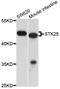 Serine/threonine-protein kinase 25 antibody, STJ111804, St John