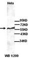 DGCR8 Microprocessor Complex Subunit antibody, orb77292, Biorbyt, Western Blot image 