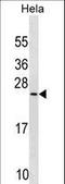 PRELI Domain Containing 1 antibody, LS-C158729, Lifespan Biosciences, Western Blot image 