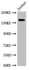 Eukaryotic Translation Initiation Factor 3 Subunit A antibody, orb53447, Biorbyt, Western Blot image 
