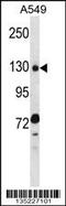 RNA Binding Motif Protein 5 antibody, 58-082, ProSci, Western Blot image 
