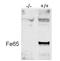 Amyloid Beta Precursor Protein Binding Family B Member 1 antibody, GTX25668, GeneTex, Western Blot image 