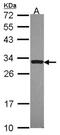 Tumor necrosis factor receptor superfamily member 6B antibody, NBP2-16112, Novus Biologicals, Western Blot image 