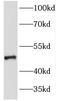 Keratin 23 antibody, FNab04651, FineTest, Western Blot image 