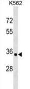 Olfactory Receptor Family 10 Subfamily AD Member 1 antibody, abx030093, Abbexa, Western Blot image 