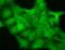 Gamma-Aminobutyric Acid Type A Receptor Delta Subunit antibody, MA5-27697, Invitrogen Antibodies, Immunofluorescence image 