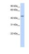 CCM2 Like Scaffold Protein antibody, NBP1-70461, Novus Biologicals, Western Blot image 