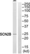 Sodium Voltage-Gated Channel Beta Subunit 2 antibody, TA314509, Origene, Western Blot image 
