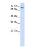 Transmembrane And Coiled-Coil Domains 3 antibody, NBP1-62589, Novus Biologicals, Western Blot image 