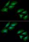 Cleavage Stimulation Factor Subunit 1 antibody, NBP2-42659, Novus Biologicals, Immunocytochemistry image 
