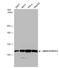 Actinin Alpha 2 antibody, NBP1-32462, Novus Biologicals, Western Blot image 