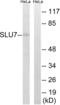 Pre-mRNA-splicing factor SLU7 antibody, LS-C120246, Lifespan Biosciences, Western Blot image 