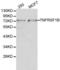 TNF Receptor Superfamily Member 1B antibody, LS-C192368, Lifespan Biosciences, Western Blot image 