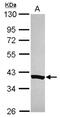 NADH:Ubiquinone Oxidoreductase Complex Assembly Factor 5 antibody, NBP2-15644, Novus Biologicals, Western Blot image 